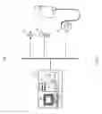 Fig. 02 - Regional citrate anticoagulation