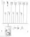 Fig. 06 - Regional citrate anticoagulation