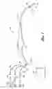 Fig. 02 - SURGICAL DEVICE AND METHOD FOR PERFORMING COMBINATION REVASCULARIZATION AND THERAPEUTIC SUBSTANCE DELIVERY TO TISSUE