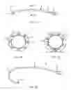 Fig. 06 - Guide catheter and method of use