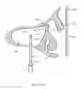 Fig. 32 - Guide catheter and method of use