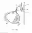Fig. 35 - Guide catheter and method of use