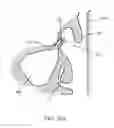 Fig. 37 - Guide catheter and method of use