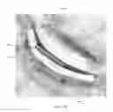 Fig. 41 - Guide catheter and method of use