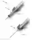 Fig. 20 - Safety needle system operable with a medical device