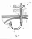 Fig. 03 - Inside out T-fastener system