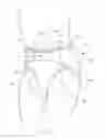 Fig. 02 - Insert with advantageous fastener configurations and end stiffness characteristics for two-piece wearable absorbent article