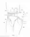 Fig. 02 - Insert with advantageous fastener configurations and end stiffness characteristics for two-piece wearable absorbent article
