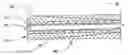 Fig. 01 - Atraumatic ureteral access sheath