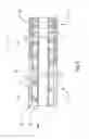 Fig. 06 - Atraumatic ureteral access sheath