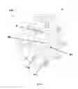 Fig. 07 - Method of percutaneous localized or focal treatment of prostate lesions using radio frequency