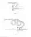 Fig. 02 - MEDICAL DEVICE FOR TISSUE ABLATION