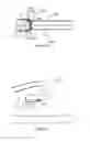Fig. 09 - MEDICAL DEVICE FOR TISSUE ABLATION