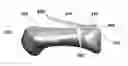 Fig. 01 - Devices, implements and methods for the treatment of a multi-axis joint