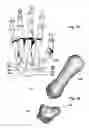 Fig. 02 - Devices, implements and methods for the treatment of a multi-axis joint