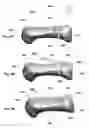 Fig. 07 - Devices, implements and methods for the treatment of a multi-axis joint