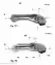 Fig. 08 - Devices, implements and methods for the treatment of a multi-axis joint