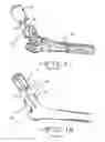 Fig. 02 - Disposable cylindrical cutter