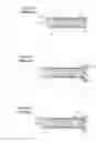 Fig. 02 - Deployment handle for an introducer