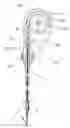Fig. 01 - Endoscopic suturing machine
