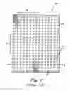 Fig. 02 - IMPLANTABLE PROSTHESIS
