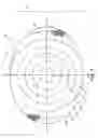 Fig. 04 - IMPLANTABLE PROSTHESIS