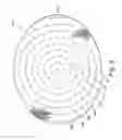 Fig. 06 - IMPLANTABLE PROSTHESIS