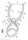 Fig. 07 - Surgical clip and surgical method for treating an aneurysm