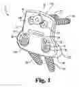 Fig. 02 - Anterior lumbar plate and method