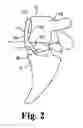 Fig. 03 - Anterior lumbar plate and method