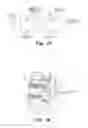 Fig. 08 - Method for stabilizing a motion segment of the spine of a patient