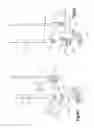 Fig. 06 - Bone fixation systems and methods of use