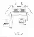 Fig. 04 - Wearable therapeutic device