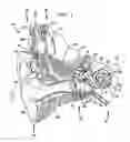 Fig. 02 - Multi-electrode channel configurations for a hearing prosthesis