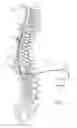 Fig. 02 - NEUROSTIMULATION LEAD ANCHORS