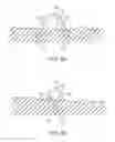 Fig. 06 - NEUROSTIMULATION LEAD ANCHORS