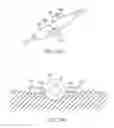 Fig. 08 - NEUROSTIMULATION LEAD ANCHORS