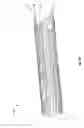 Fig. 08 - Expandable endoprostheses, systems, and methods for treating a bifurcated lumen