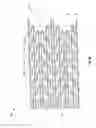 Fig. 09 - Expandable endoprostheses, systems, and methods for treating a bifurcated lumen