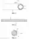 Fig. 02 - Composite prosthesis with external polymeric support structure and methods of manufacturing the same