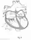 Fig. 07 - Percutaneous Mitral Annular Stitch to Decrease Mitral Regurgitation