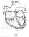 Fig. 08 - Percutaneous Mitral Annular Stitch to Decrease Mitral Regurgitation