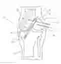Fig. 01 - Method and Apparatus for Fixing a Graft in a Bone Tunnel