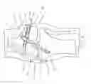 Fig. 09 - Method and Apparatus for Fixing a Graft in a Bone Tunnel