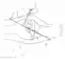 Fig. 19 - Method and Apparatus for Fixing a Graft in a Bone Tunnel