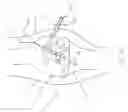 Fig. 20 - Method and Apparatus for Fixing a Graft in a Bone Tunnel
