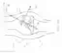 Fig. 34 - Method and Apparatus for Fixing a Graft in a Bone Tunnel
