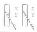 Fig. 48 - Method and Apparatus for Fixing a Graft in a Bone Tunnel