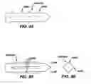 Fig. 53 - Method and Apparatus for Fixing a Graft in a Bone Tunnel