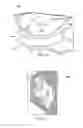 Fig. 13 - Meniscus prosthetic device selection and implantation methods